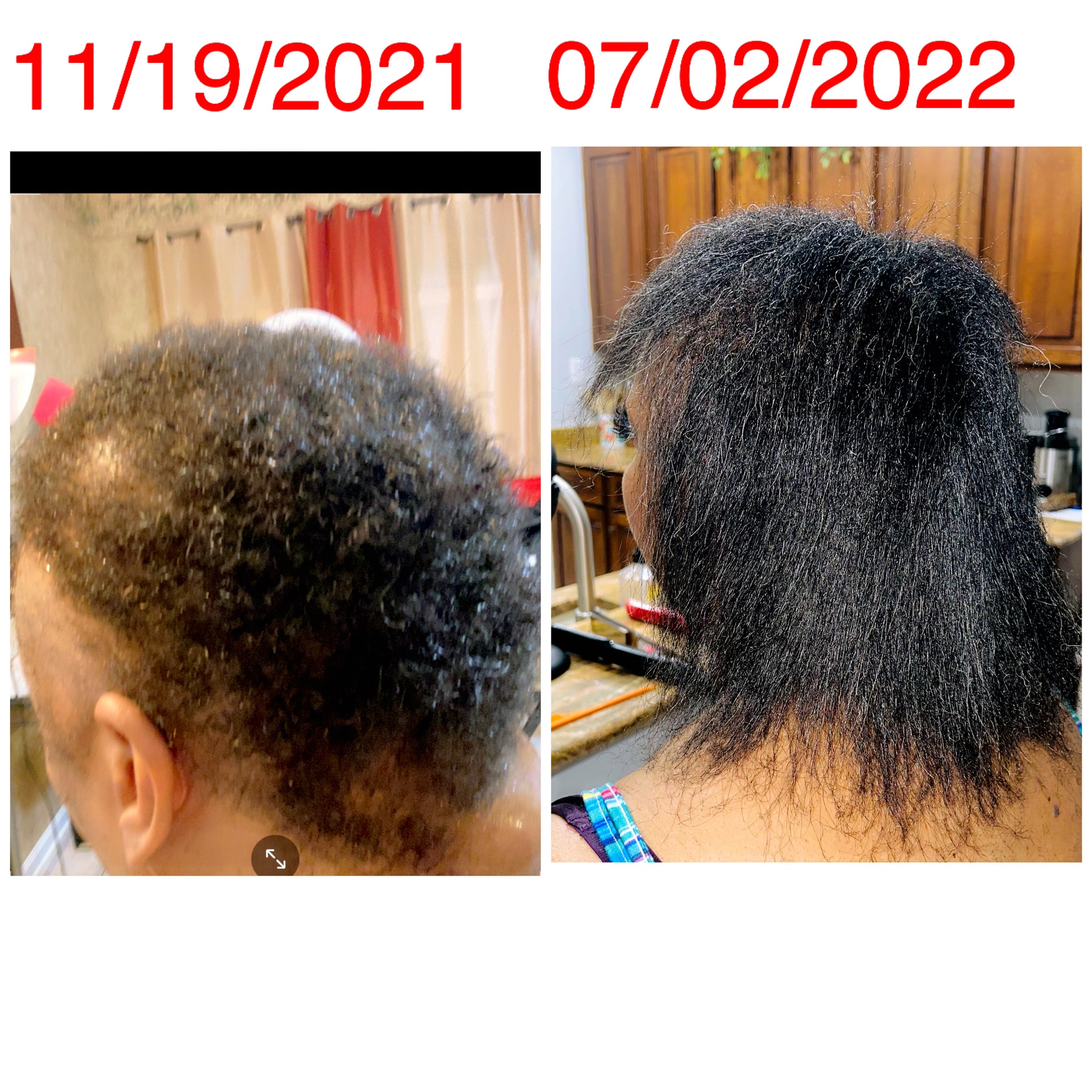 Hope Hair Growth Oil Serum