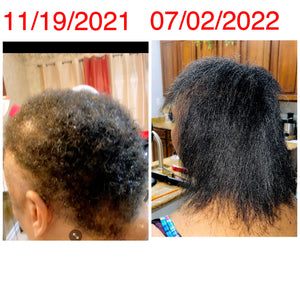 Hope Hair Growth Oil Serum