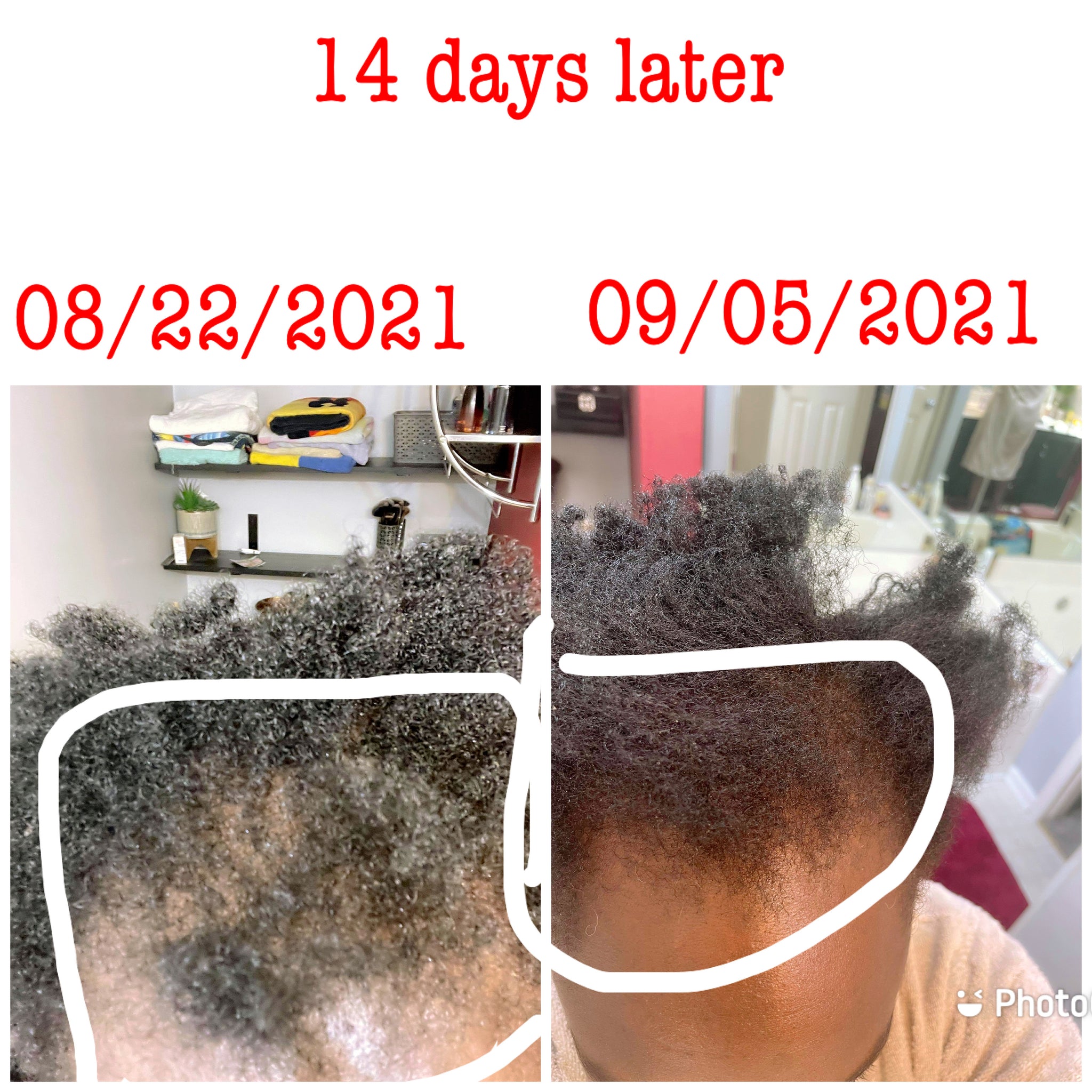 Hope Hair Growth Oil Serum