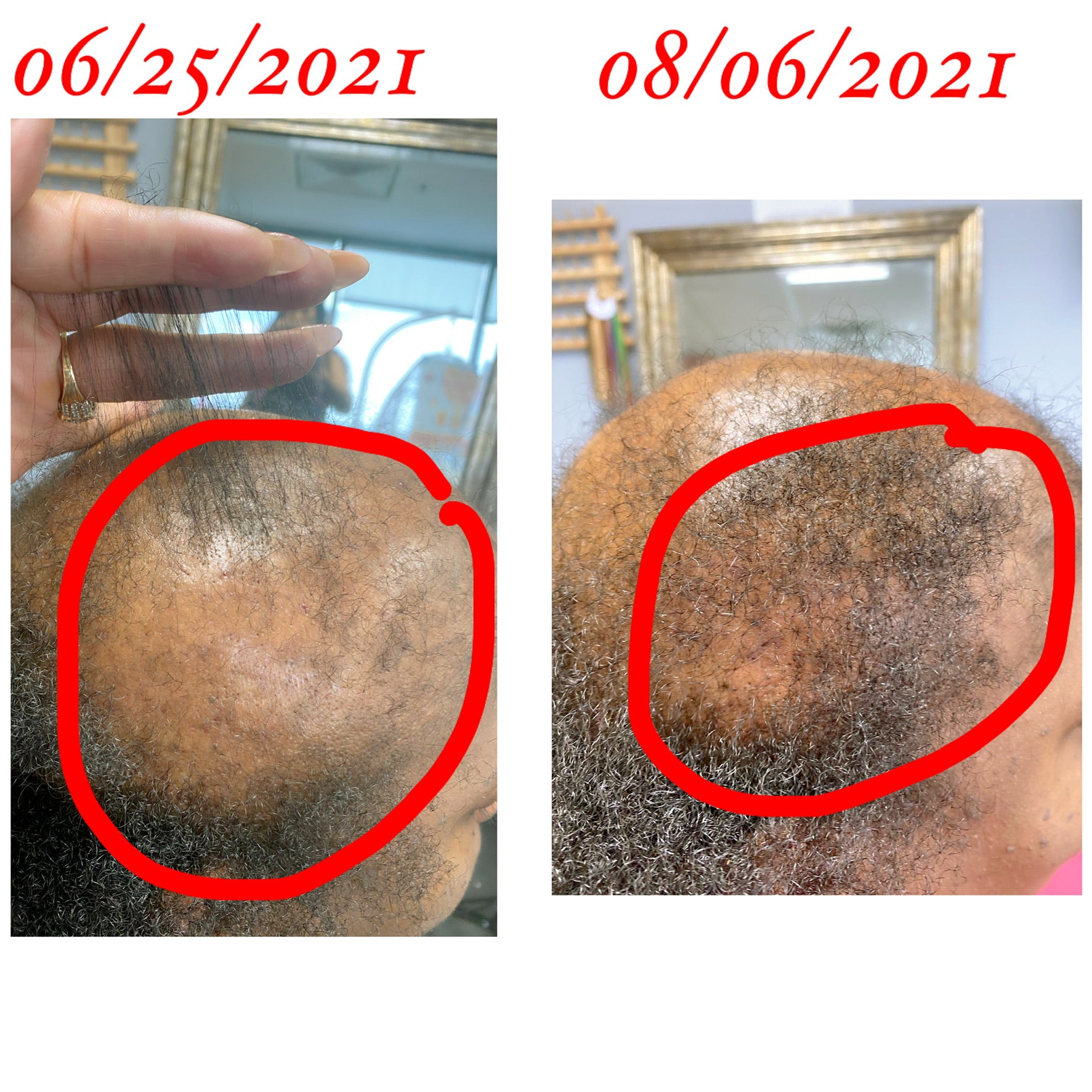 Hope Hair Growth Oil Serum