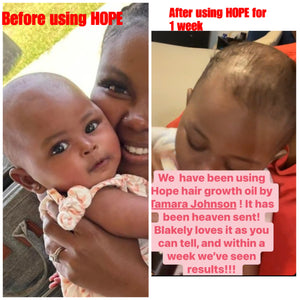 Hope Hair Growth Oil Serum (Original)